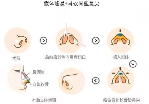 长沙华韩华美开展项目科普