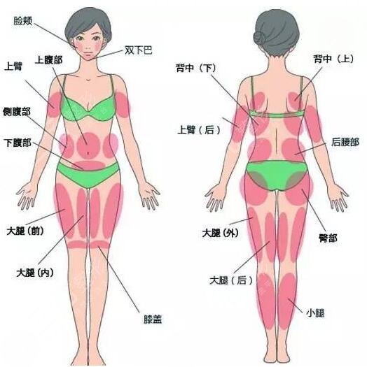 上海安缦医疗美容门诊腿部吸脂后