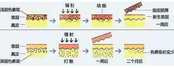 祛斑小偏方都有哪些?