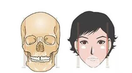 颧骨磨骨手术优点和缺点