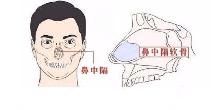 嘉兴隆鼻项目科普