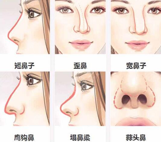 贵州省人民医院整形外科专家