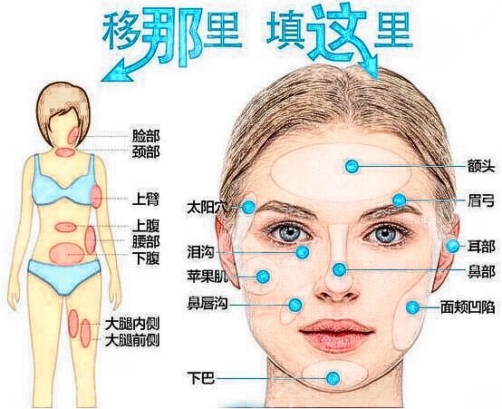 南宁三0三医院整形中心面部填充案例