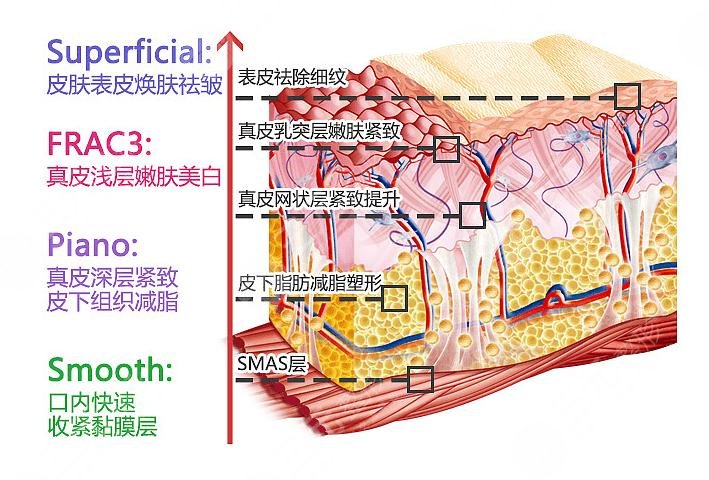 光子疗法