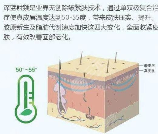 深蓝射频做一次有效果吗？多少钱一次？抗衰除皱术前攻略~