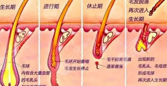 激光脱毛