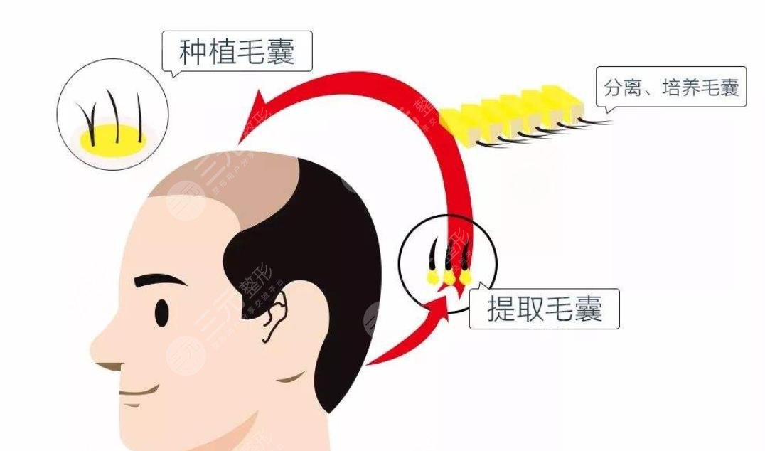 南方医科大学南方医院项目科普