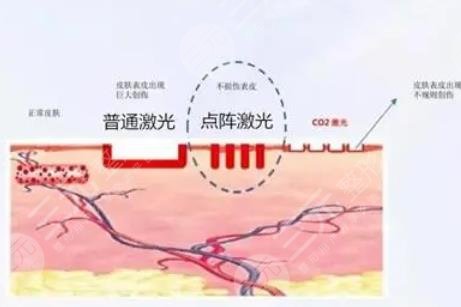 广州南方医院擅长项目：