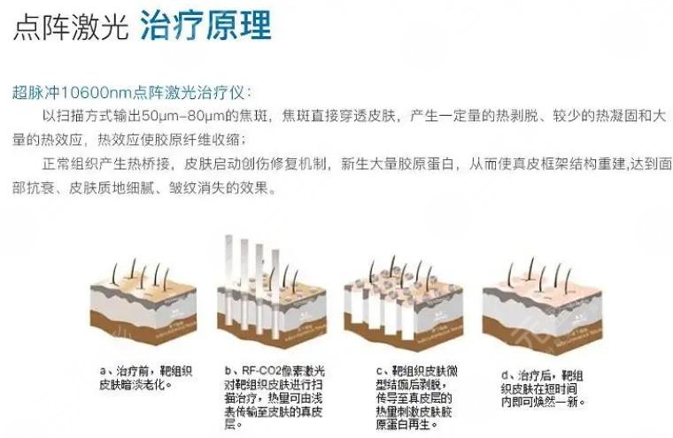 深圳第二人民医院整形科擅长项目