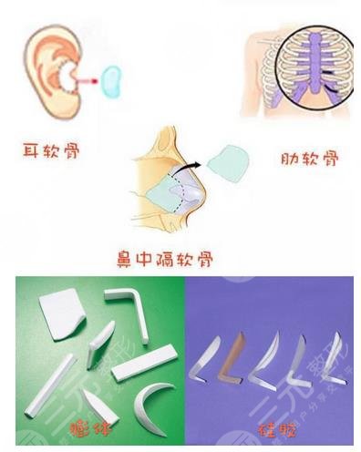 肋软骨隆鼻的操作原理是怎样的?