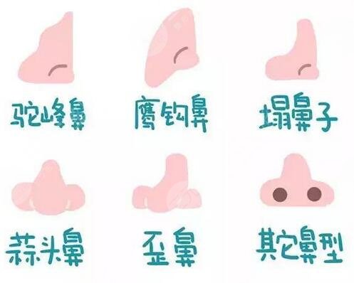 进口膨体隆鼻案例果