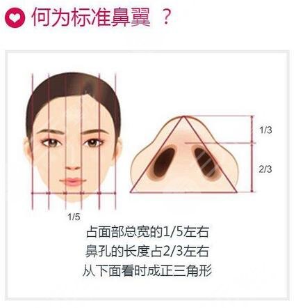 陈付国做鼻子术后3个月