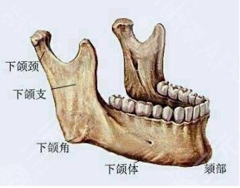 磨骨术后