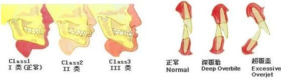 正颌