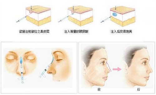 北京十优医疗美容面部抗衰案例