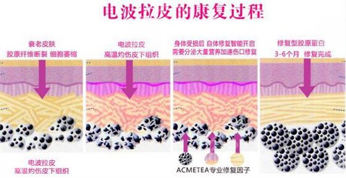 成都八大处医疗美容医院拉皮除皱案例