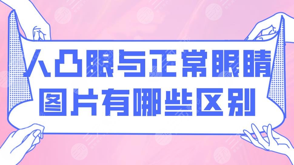 眼突和眼鼓的区别图片图片