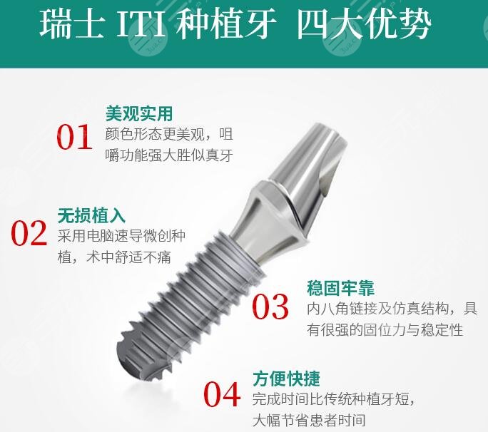 瑞士ITI种植牙