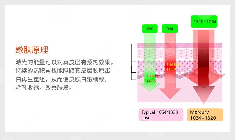 激光嫩肤有后遗症吗