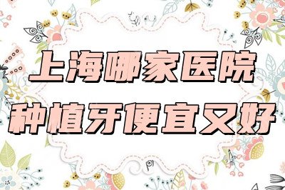 上海哪家医院种植牙便宜又好？上海九院、圣贝口腔、拜博口腔等都不错