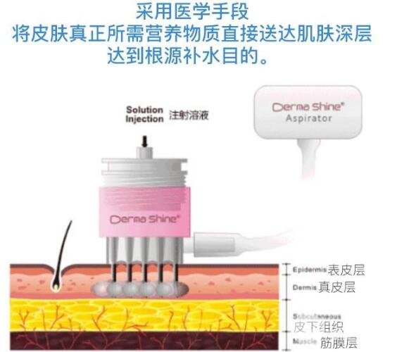 用什么方式能作用在货源优质层呢?