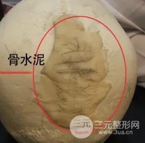 女明星动了这个地方之后，颜值一下子提高了两个档次~