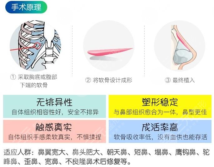 上海联合丽格美容医院范荣杰医生科普隆鼻