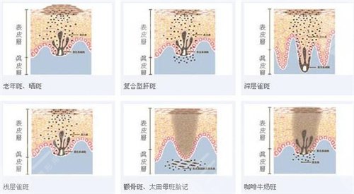 干净面容能够提升整体形象