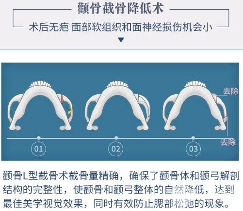 明星喜欢的整容手术