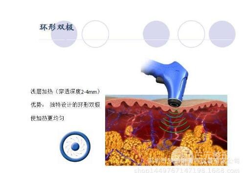 深蓝射频治疗流程