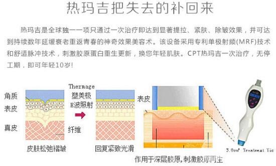 热玛吉间隔多久做一次