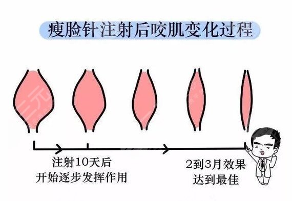 贵州赤水市人民医院注射瘦脸怎么样