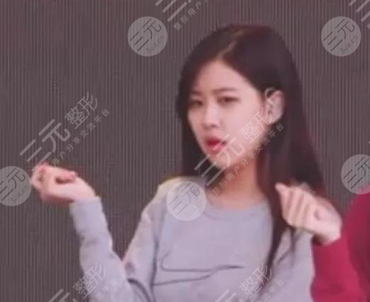 BLACKPINK朴彩英(Rosé)整容了?