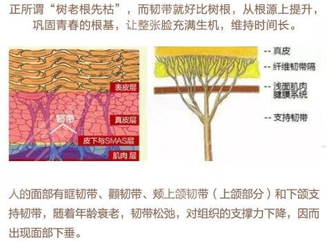 袁伟 拉皮技术