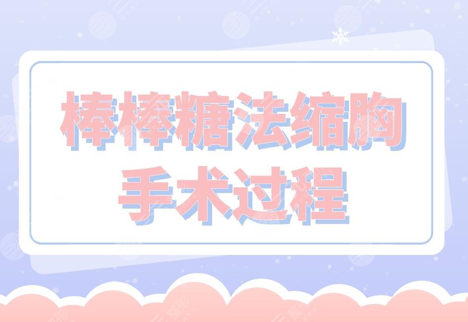 棒棒糖法缩胸手术过程是怎样的？手术的原理是怎么样的？