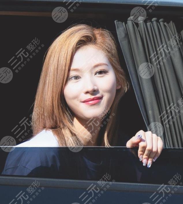 TWICE凑崎纱夏(sana)颜值如何?