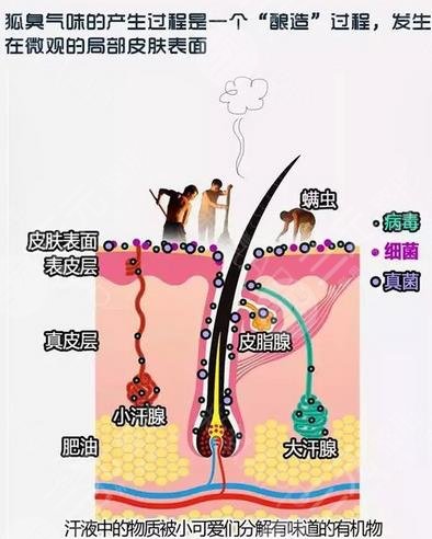 手术去狐臭原理