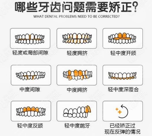 牙齿矫正有哪些作用