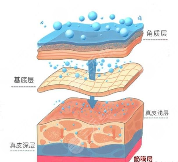 超声炮可以改善哪些衰老问题?