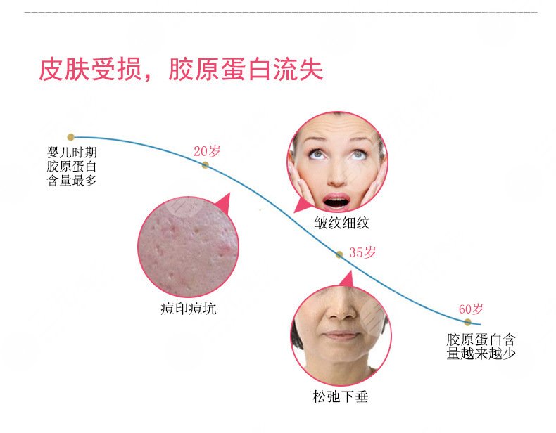 藏不住的鱼尾纹如何去除?