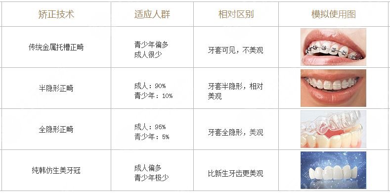 合肥市口腔医院科普牙齿矫正