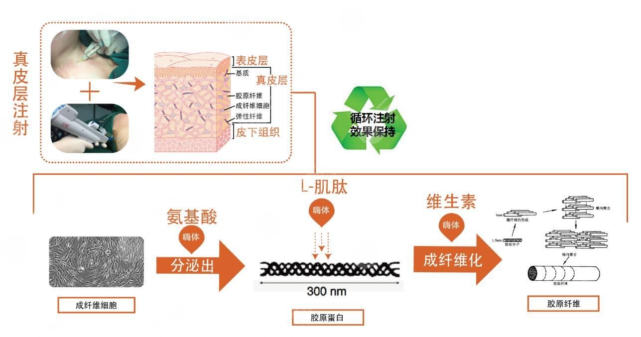 嗨体填充泪沟之后需要注意哪些?