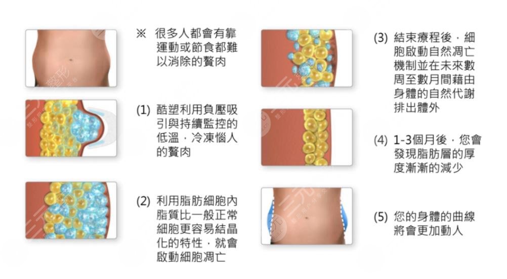 酷塑溶脂