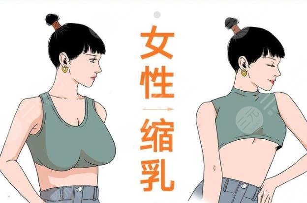 乳房缩小棒棒糖手术术前需要准备哪些工作?