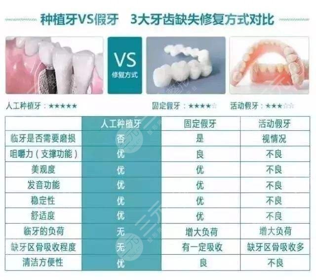 种植牙技术的**