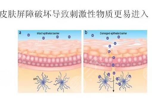 维纳斯抗衰仪多少钱一次?原理_作用功_面部抗衰案例果图来袭!