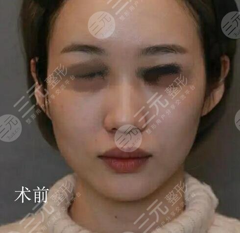 北京煤医美丽佳人美医疗美容医院整形医生