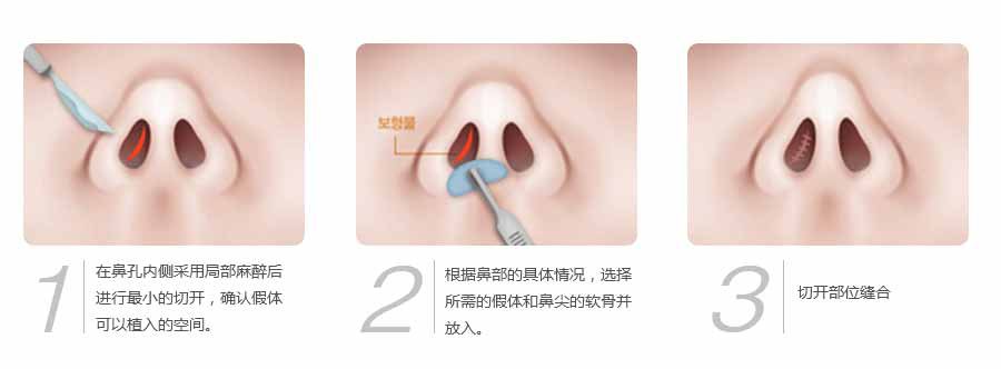 襄阳伯蒂整形医院怎么样?价格表医生口碑详细一览