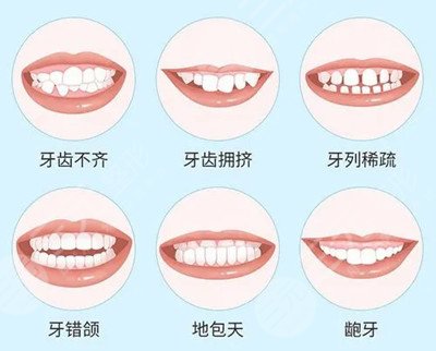 上海第九人民医院牙齿矫正多少钱？价格表+案例图