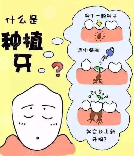 深圳牙齿种植项目案例体验反馈：